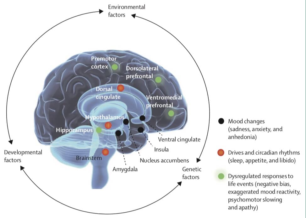 11国专家撰文呼吁重视抑郁症，中国作者：单靠卫生系统解决不了